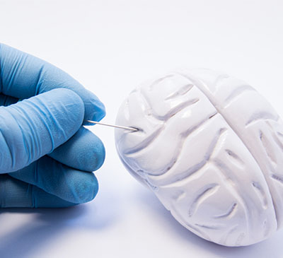 Global Glioma Therapeutics Market 2019-2023